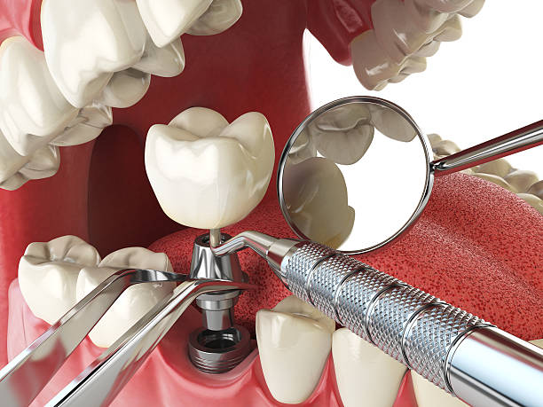 Best Mobile Emergency Dentist in Moss Point, MS