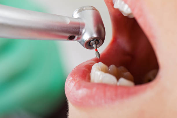 Best Weekend Emergency Dentist in Moss Point, MS